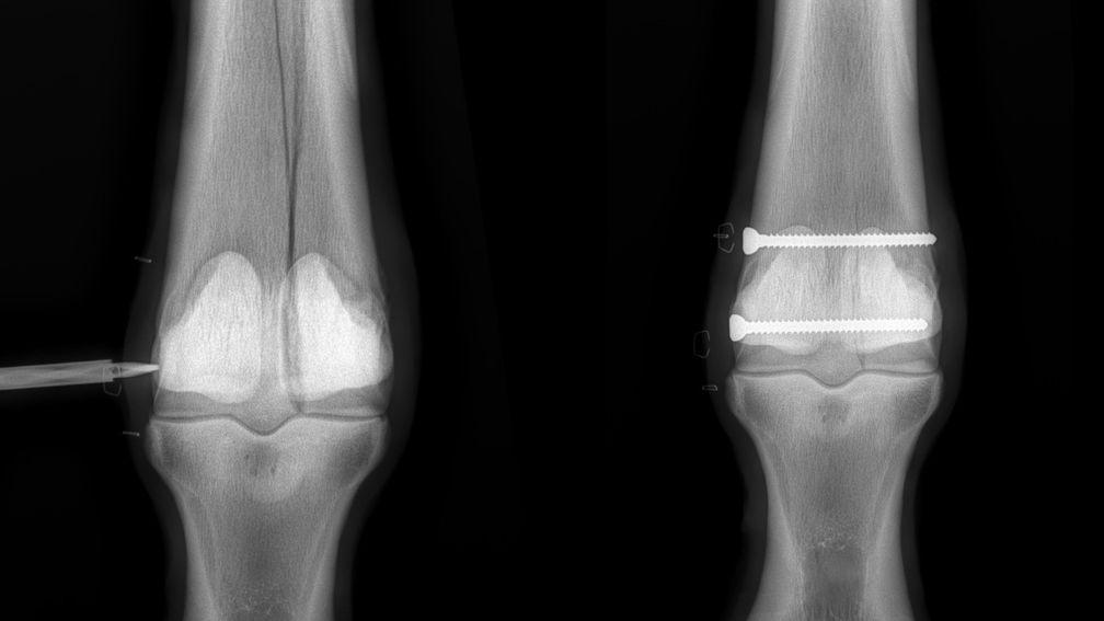 Surgery update: an x-ray of Amhran Na Bhfiann's fetlock before the procedure on the left, alongside an x-ray after two pins were inserted on the right